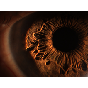 Eye Examination Under Magnification 